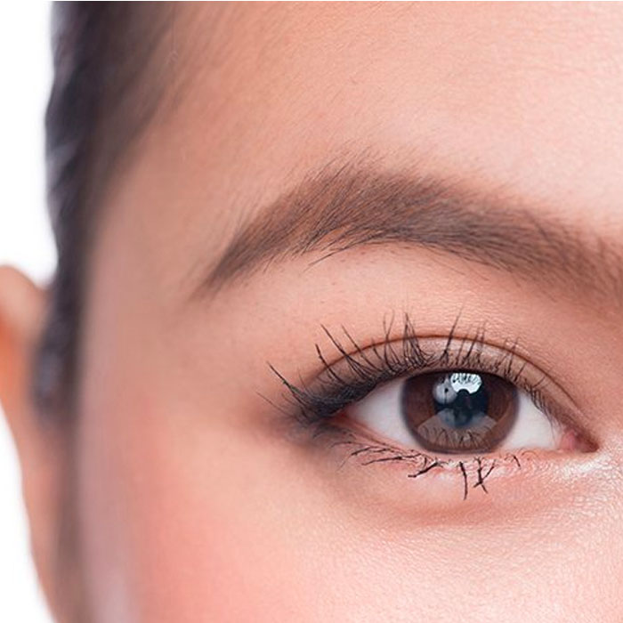 brow lift hifu treatment
