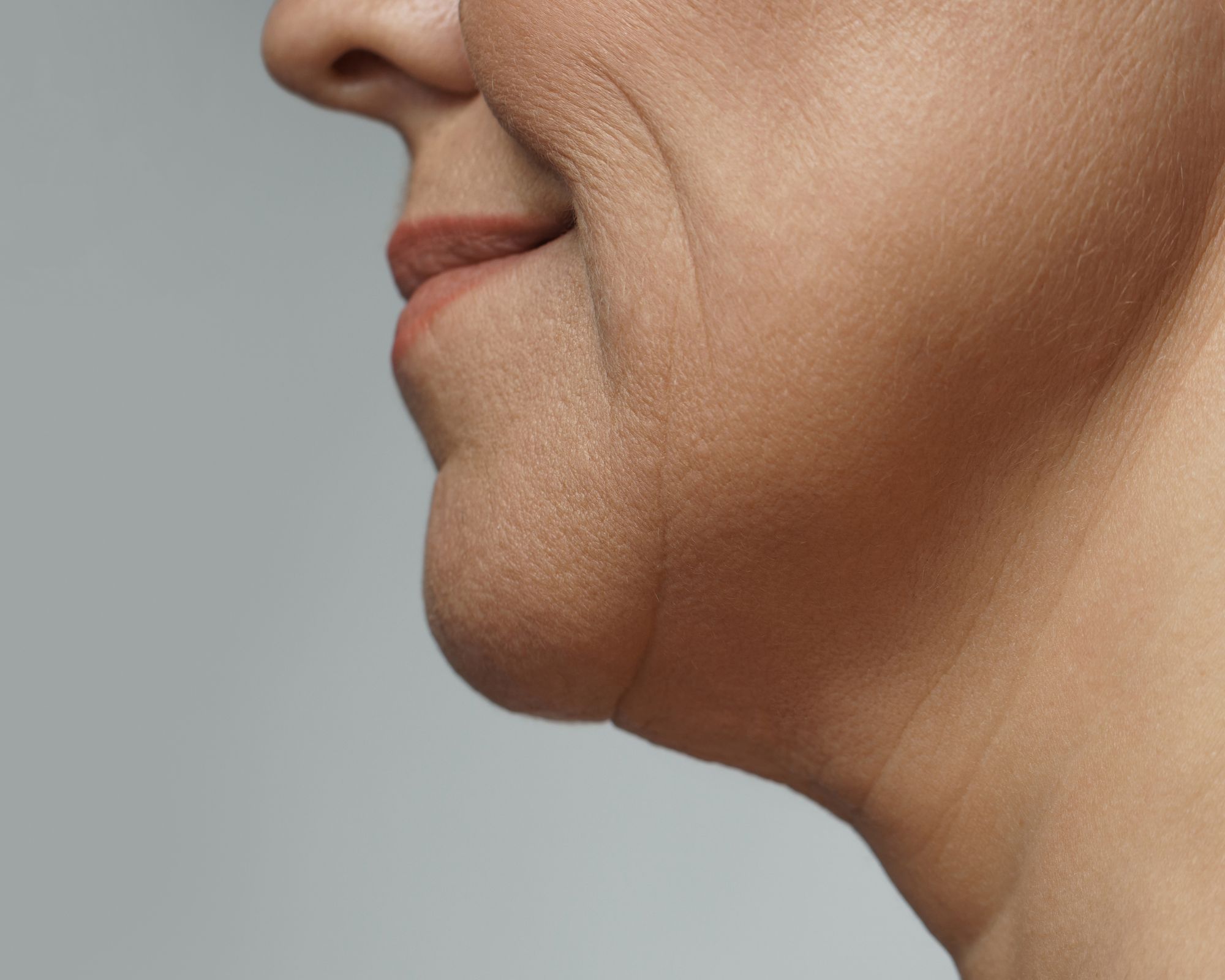 Saggy-skin-beauty-secret-hifu
